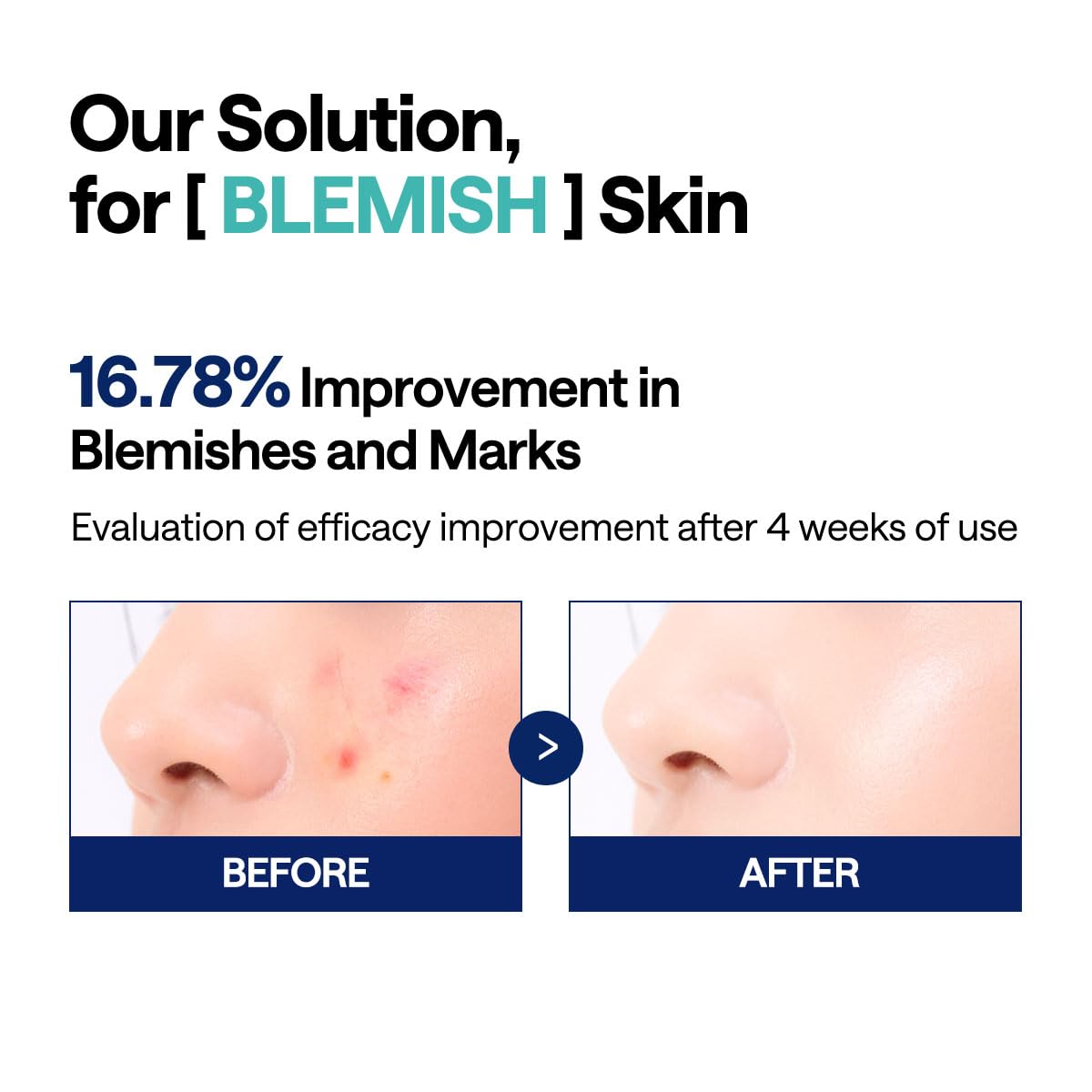MEDIHEAL Madecassoside Toner Pads for Blemishes and Uneven Skin Tone - Vegan Gauze, 100 Pads