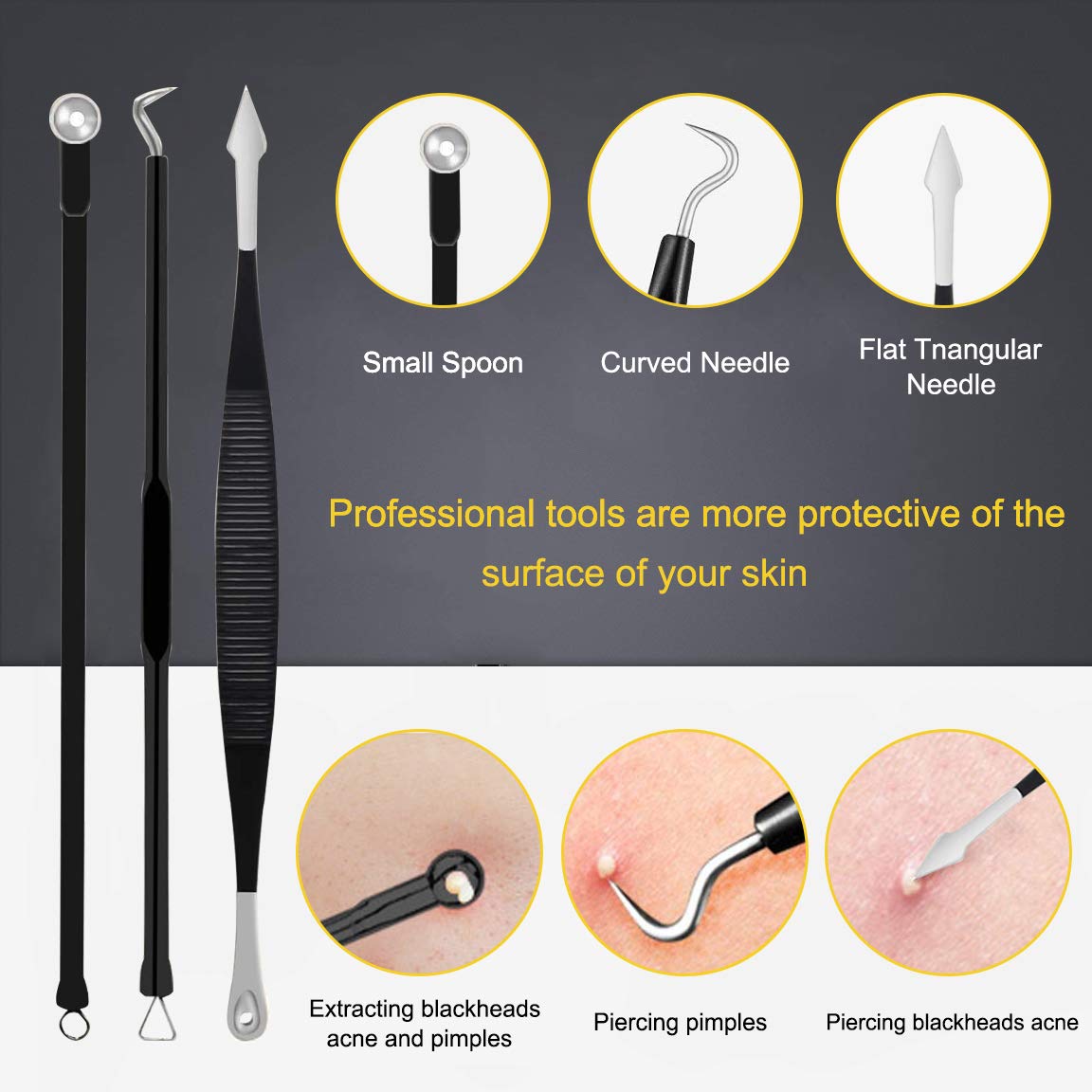 boxoyx 10 pcs pimple remover comedone extractor kit with box for quick and easy removal