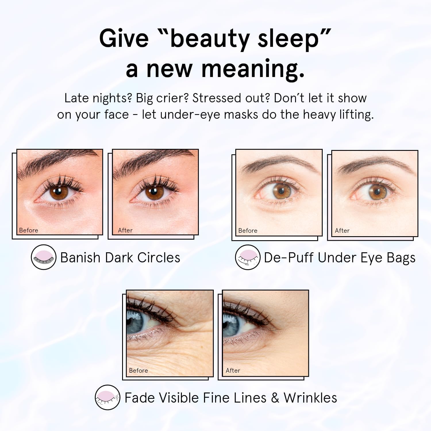 grace & stella Retinol Under Eye Patches for Puffy Eyes & Dark Circles - Restoring Gel Under Eye Masks with Hyaluronic Acid - Purple, 24 Pairs for Women