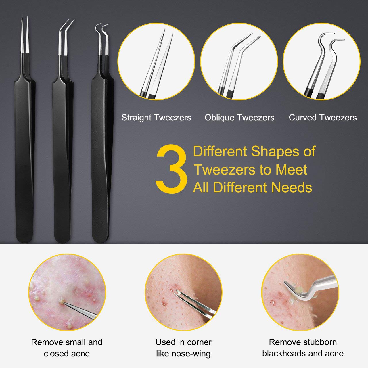 boxoyx 10 pcs pimple remover comedone extractor kit with box for quick and easy removal