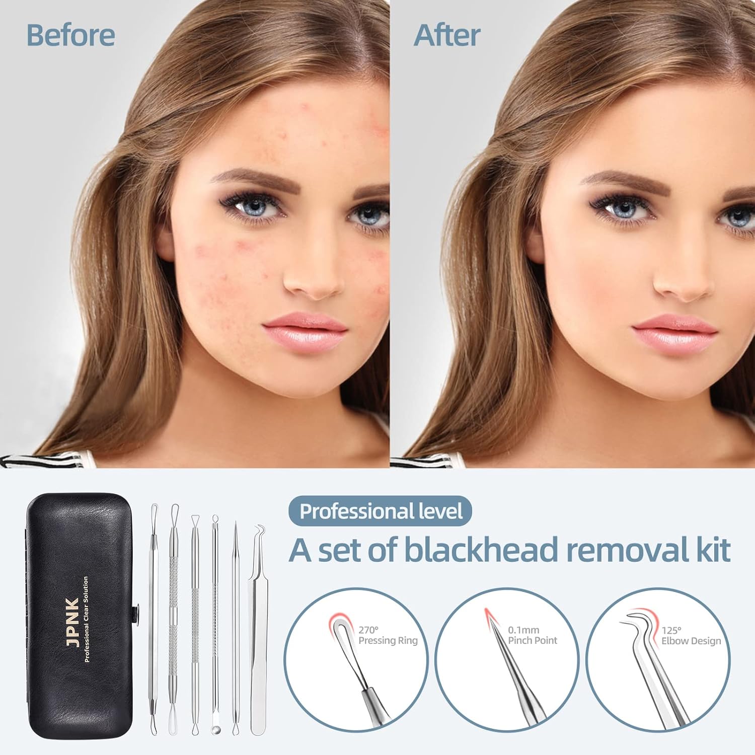 jpnk blackhead remover tool comedones extractor acne removal kit for blemish whitehead popping 6 pc zit removing for nose face tools with leather bag