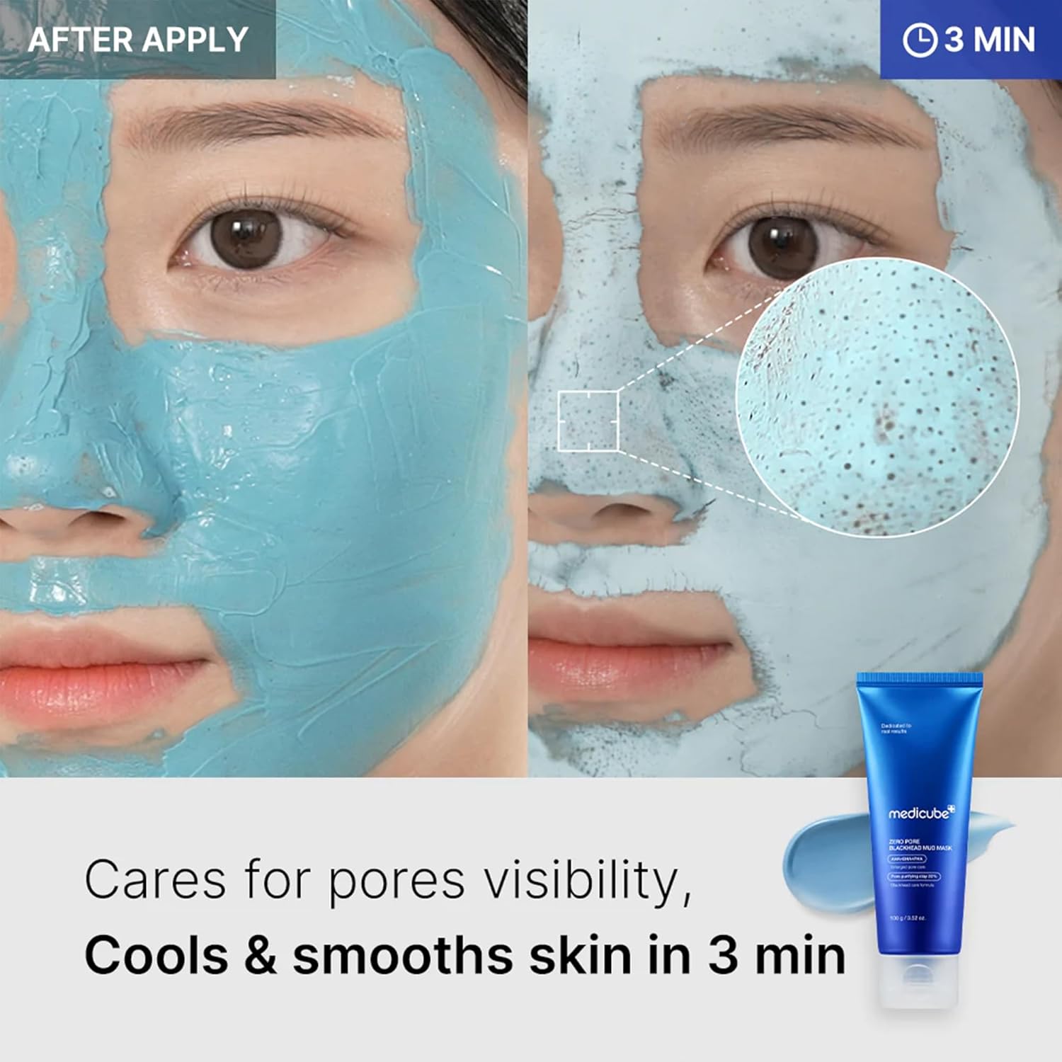 Medicube Zero Pore Blackhead Mud Facial Mask, Korean, AHA, BHA, PHA, 3-minute quick dry formula, 3.52 oz, blackhead removal, pore tightening