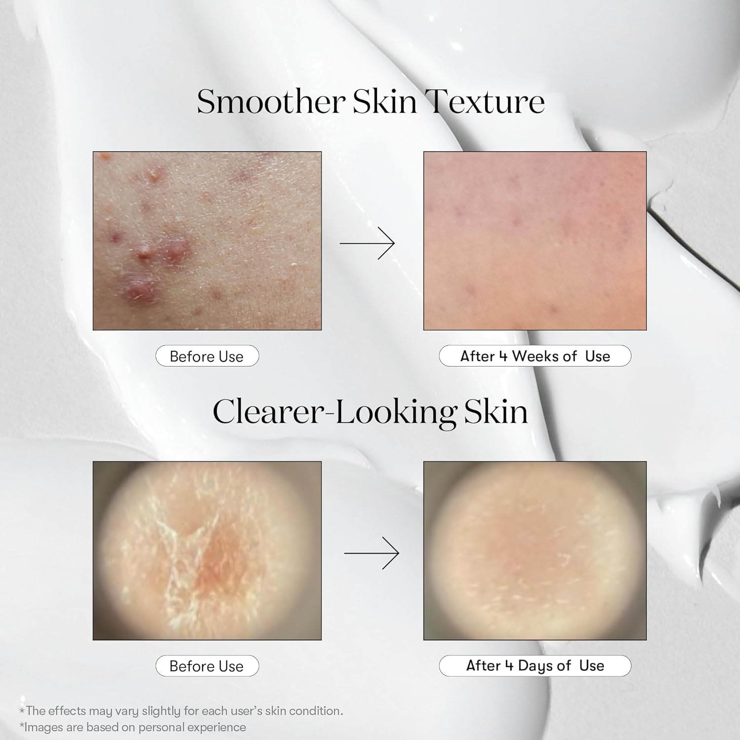 vt cosmetics cica reedle shot 300, 1.69fl oz, microneedling serum, korean skin booster with centella asiatica and hyaluronic acid