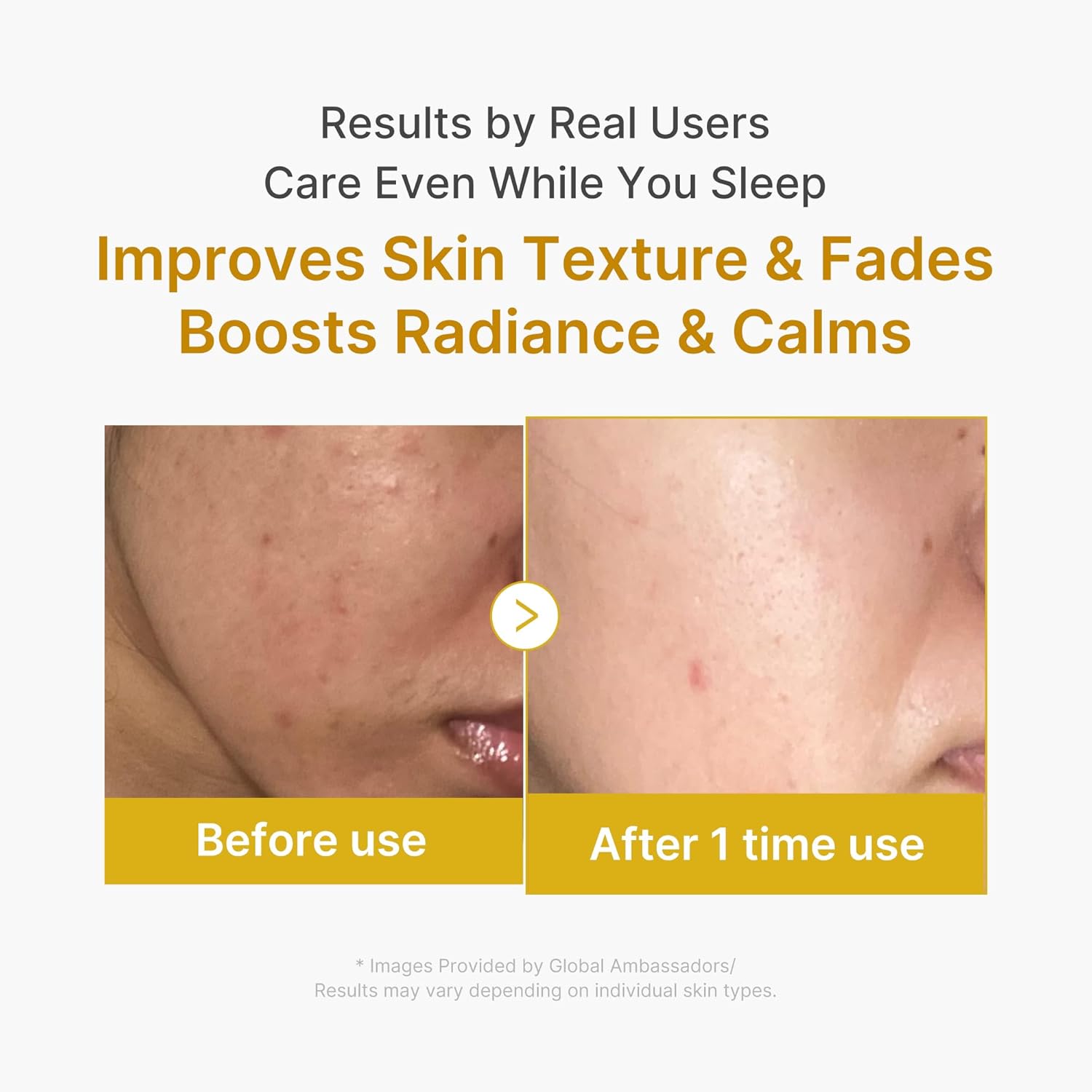 medicube Wrapping Mask Kojic Acid and Turmeric Overnight Peel Off Facial Mask, 2.53 fl.oz, Korean Skin Care