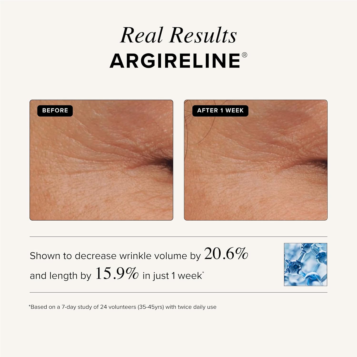 Asterwood Triple Repair Serum with Matrixyl 3000, Argireline, Hyaluronic Acid, and Vitamin C for anti-aging and collagen boosting - fragrance-free - 1 fl oz