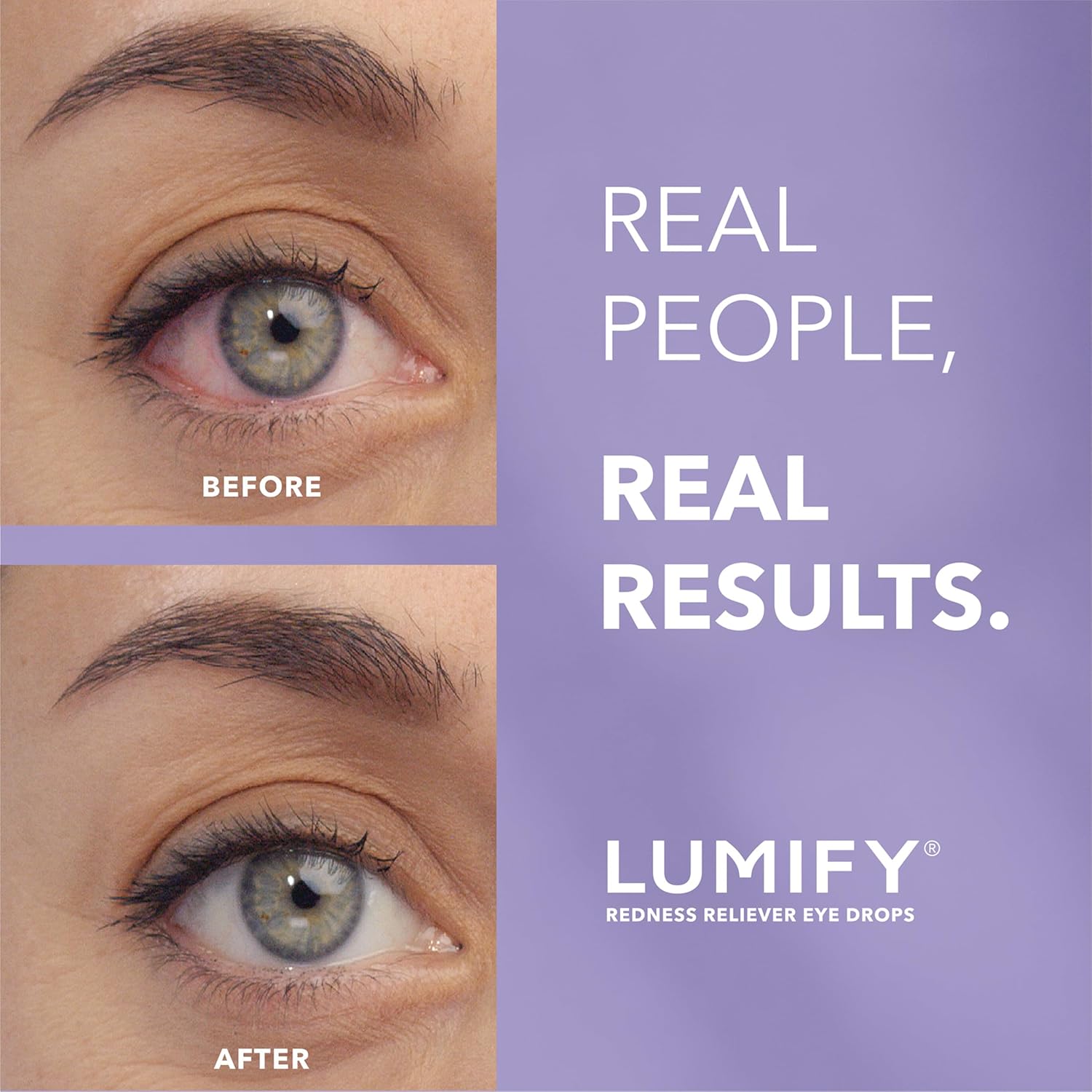 Lumify eye drops for red eyes relief 0.08 fl oz 2.5ml fda approved