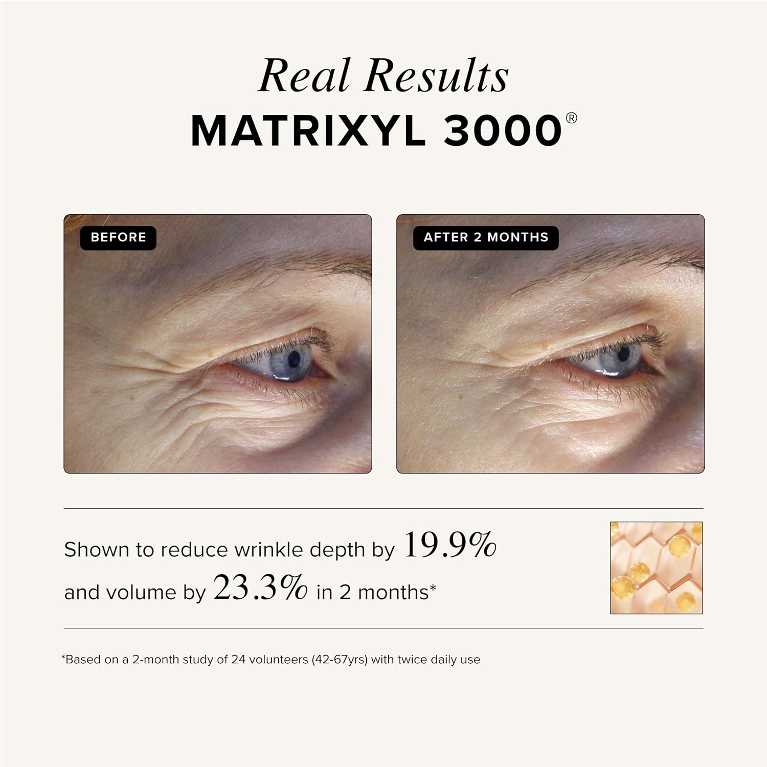 Asterwood Triple Repair Serum with Matrixyl 3000, Argireline, Hyaluronic Acid, and Vitamin C for anti-aging and collagen boosting - fragrance-free - 1 fl oz